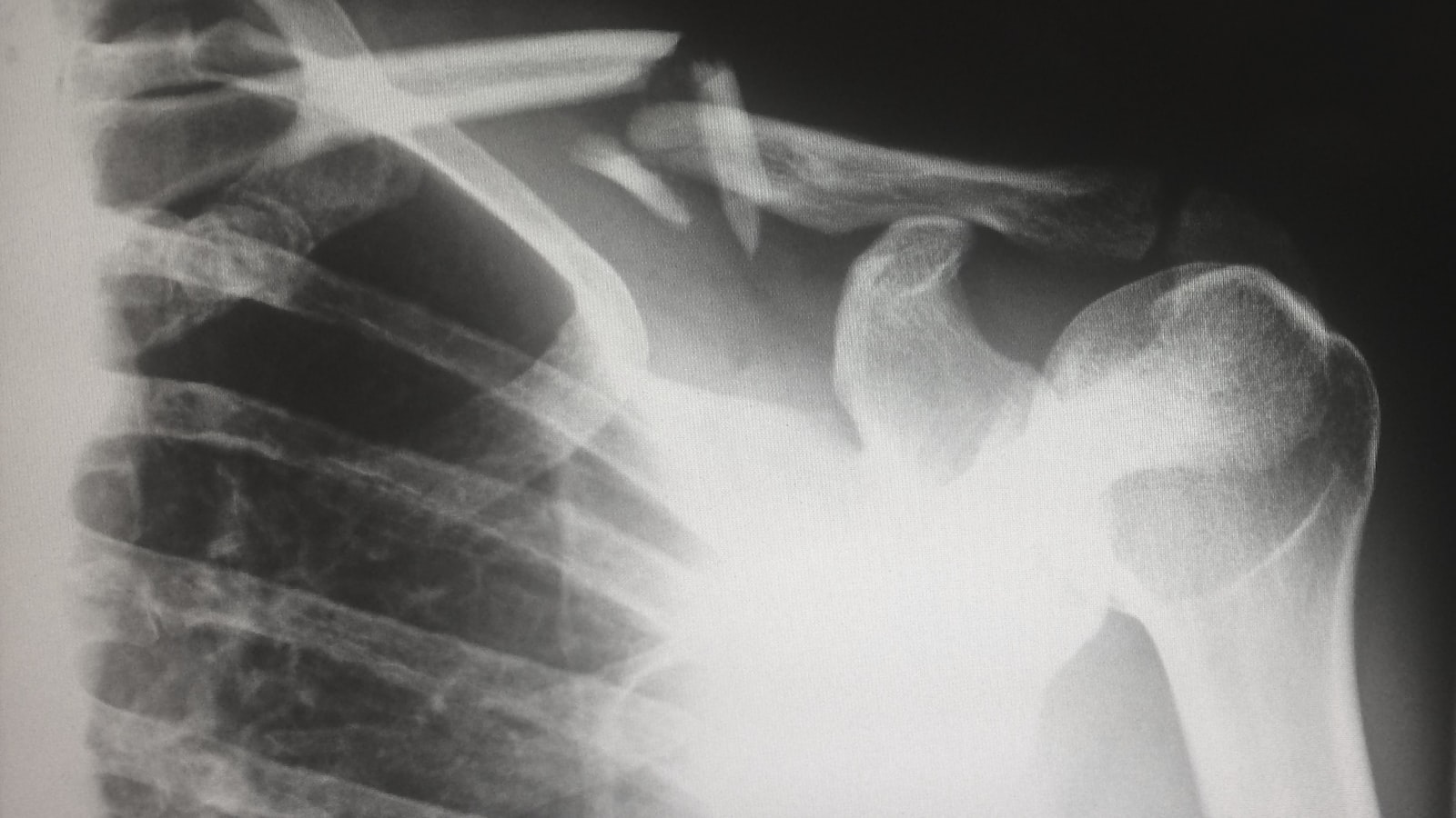 Gut Health: Unlocking the Power of the Microbiome